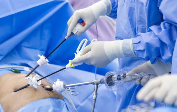 LAPAROSCOPIC AND GYNAECOLOGICAL SURGERIES